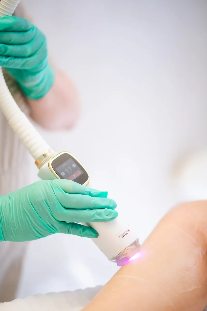 Aparat Epilare Definitiva Laser Emirav