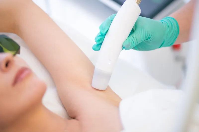 Echipament Epilare Laser Salon Ilfov