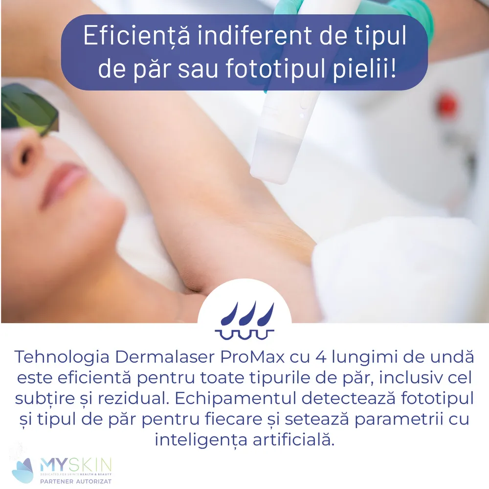 Eficiență Maximă
